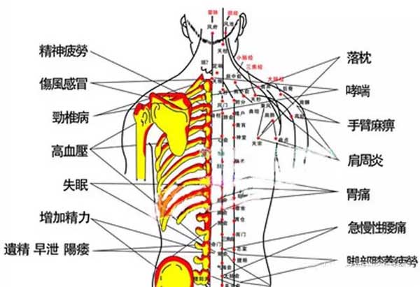 拔罐后的“罐印”暗示身体有哪些疾病？