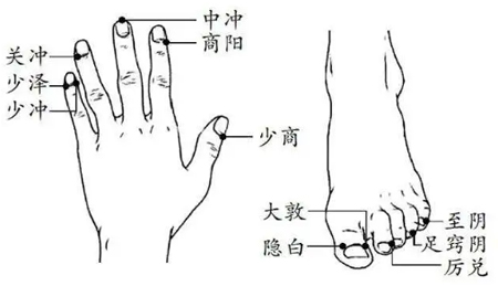 针灸治疗高血压-第3张图片-中国中医健康网