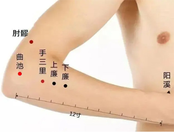 针灸治疗高血压-第7张图片-中国中医健康网