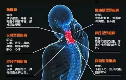 颈椎病、腕关节疼痛的主穴、解结与放血-第1张图片-中国中医健康网